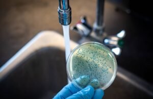 RD ya suma 47 casos de cólera, reportan cuatro nuevos contagios